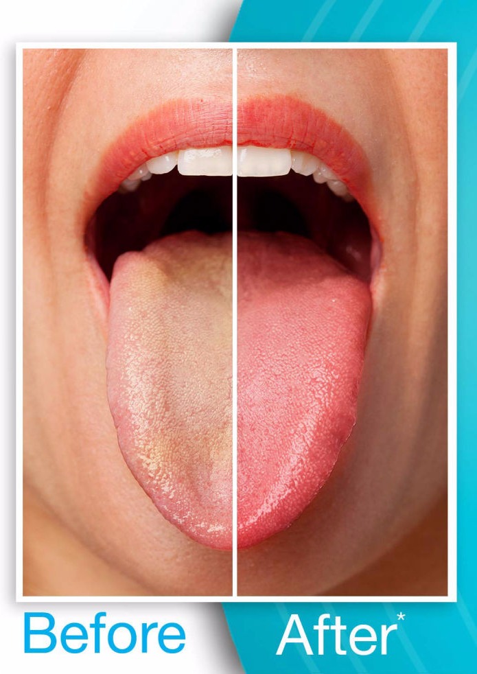 Why you should tongue clean with a tongue scraper